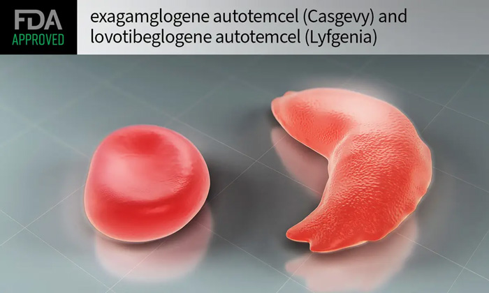 CASGEVY