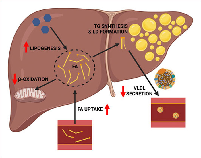 DETOXIFICACION HEPATICA