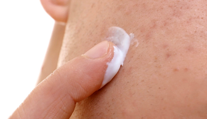 MICROBIOTA CUTANEA