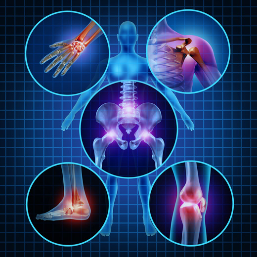 INFLAMACION SILENCIOSA